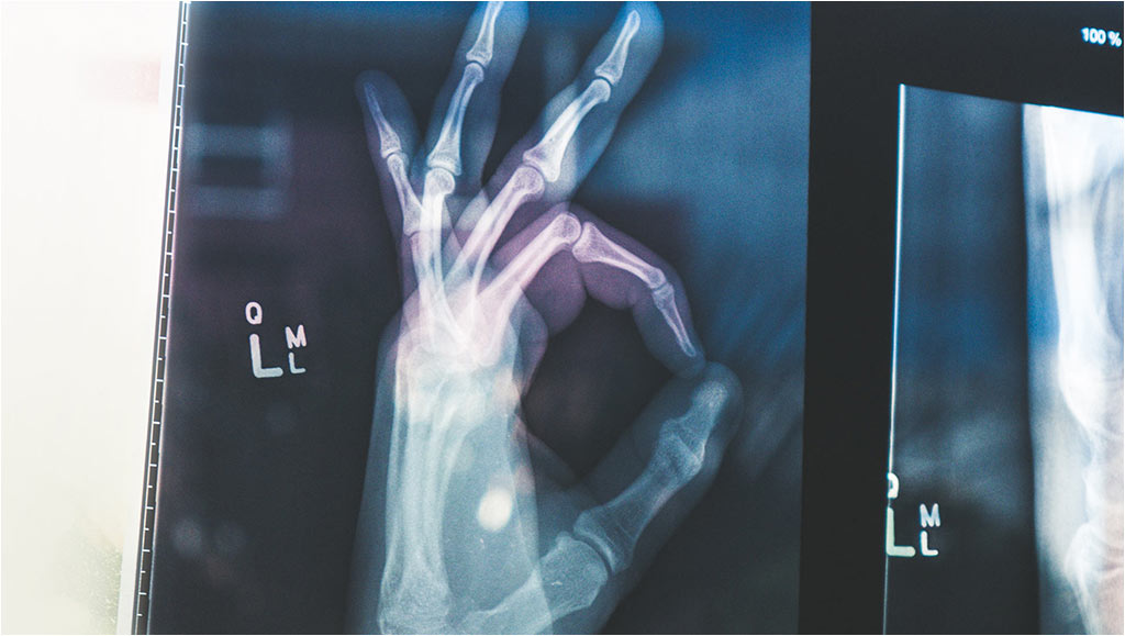 A hand showing an OK sign on an X-ray